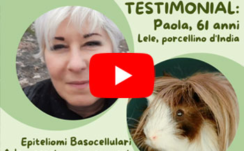 testimonianza paola tumore pelle